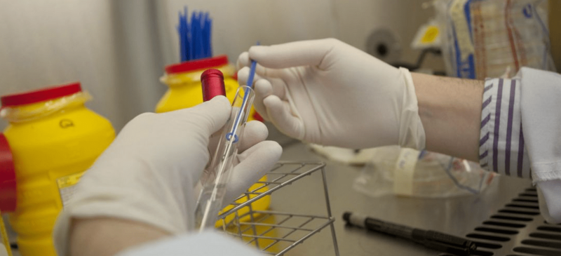 Imagen de archivo de una prueba de detección de viruela del mono / TA